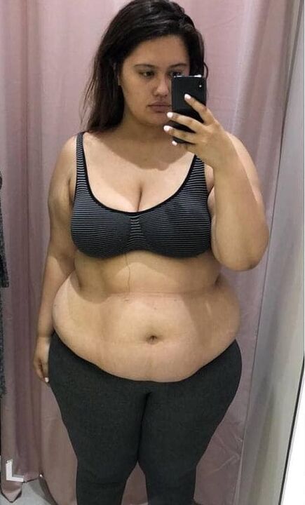 Nekenčiau savo kūno dėl papildomų kilogramų.